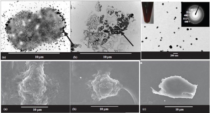 In vitro anticancer activity of doxorubicin-loaded gelatin-coated magnetic iron oxide nanoparticles
