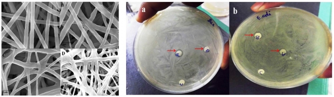 Emu oil-based electrospun nanofibrous scaffolds for wound skin tissue engineering