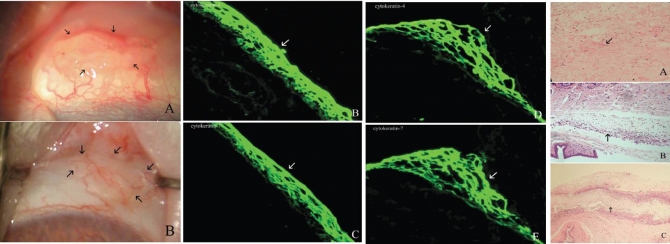 Biocompatibility of nanocomposites used for artificial conjunctiva: In vivo experiments